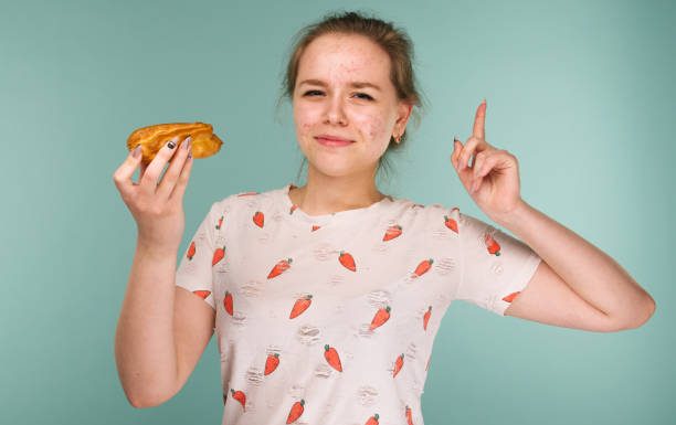 Adult Acne Diet: What foods to eat and avoid to treat acne? adult/hormonal acne diet