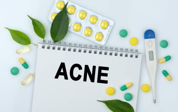 The Best Supplements for Adult Acne supplements for adult acne